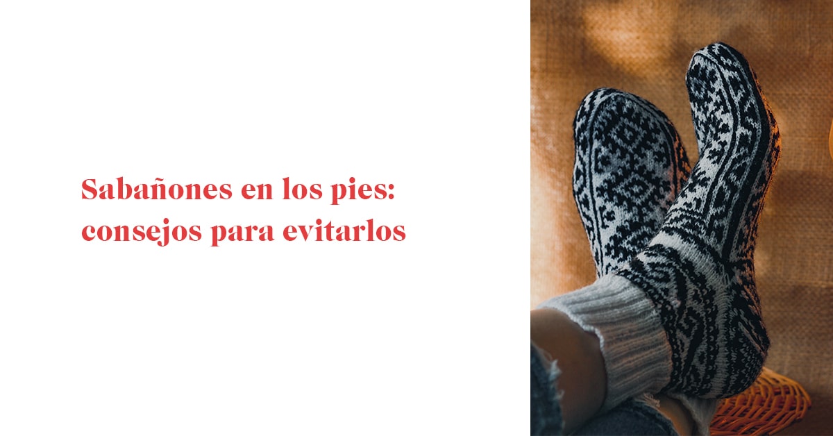 Sabañones en los pies: consejos para evitarlos